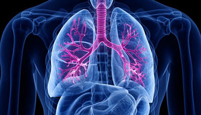 什么是慢性阻塞性肺病 (Chronic Obstructive Pulmonary Disease)，為何與新冠疫情有關(guān)？